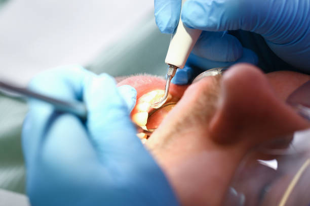 Best Weekend Emergency Dentist in Talluh, LA