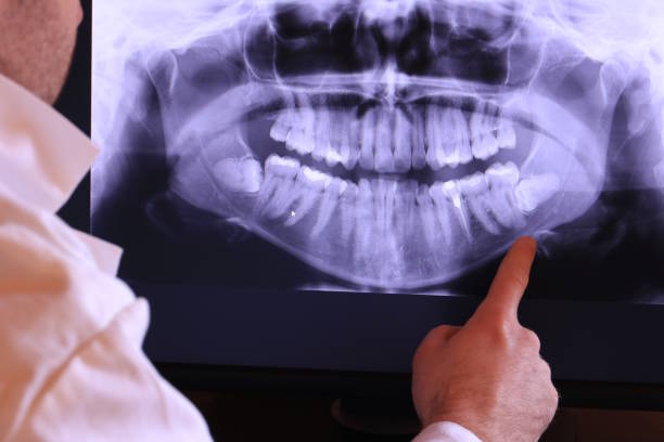 Best Emergency Denture Repair in Talluh, LA