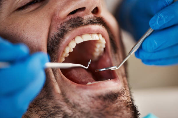 Best Emergency Gum Treatment in Talluh, LA